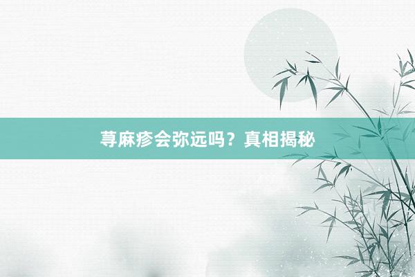 荨麻疹会弥远吗?真相揭秘